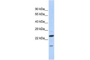 INSIG2 antibody used at 1 ug/ml to detect target protein. (INSIG2 antibody  (N-Term))