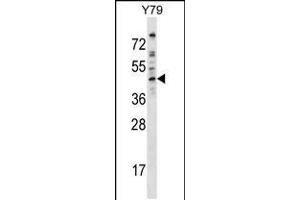 Western blot analysis in Y79 cell line lysates (35ug/lane). (Dematin antibody  (AA 249-277))