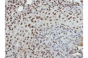 IHC-P Image Immunohistochemical analysis of paraffin-embedded HSC3 xenograft, using Histone H3. (Histone H3.3B antibody  (full length))
