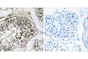 Peptide - +Immunohistochemistry analysis of paraffin-embedded human testis tissue using ELOVL2 antibody.