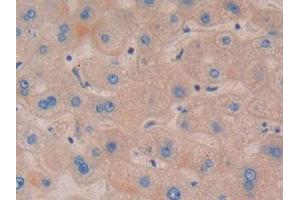 DAB staining on IHC-P; Samples: Human Liver Tissue (NOD1 antibody  (AA 612-826))