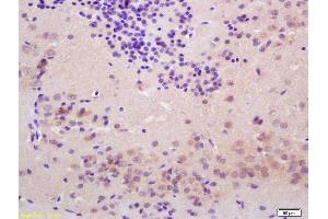 Formalin-fixed and paraffin embedded rat brain labeled with Rabbit Anti Thyroid peroxidase Polyclonal Antibody, Unconjugated (ABIN1713917) at 1:200 followed by conjugation to the secondary antibody and DAB staining (Thyroperoxidase antibody  (AA 111-210))