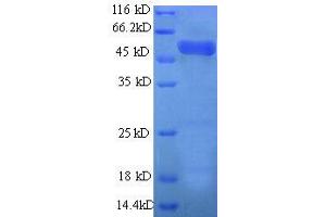 Actin Related Protein 2/3 Complex, Subunit 2, 34kDa (ARPC2) (AA 1-250), (partial) protein (GST tag)