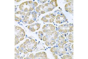 Immunohistochemistry of paraffin-embedded human stomach using TNFRSF10A antibody (ABIN5973697) at dilution of 1/100 (40x lens). (TNFRSF10A antibody)