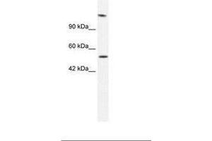Image no. 1 for anti-DNA Helicase B (HELB) (AA 77-126) antibody (ABIN202971) (DNA Helicase B antibody  (AA 77-126))