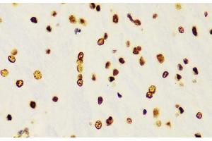 Immunohistochemistry of paraffin-embedded Rat brain using DiMethyl-Histone H3-K4 Polyclonal Antibody at dilution of 1:100 (40x lens). (Histone 3 antibody  (2meLys4))