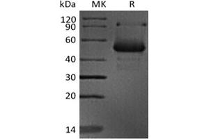 Western Blotting (WB) image for CD40 Ligand (CD40LG) protein (ABIN7319782) (CD40 Ligand Protein (CD40LG))