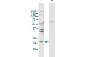Western Blot analysis of TIMP2 expression in transfected 293T cell line by TIMP2 MaxPab polyclonal antibody. (TIMP2 antibody  (AA 1-220))