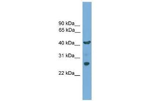 TMEM176A antibody used at 0. (TMEM176A antibody  (N-Term))