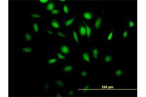 Immunofluorescence of purified MaxPab antibody to Rgr on HeLa cell. (RGL4 antibody  (AA 1-410))