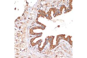Immunohistochemistry of paraffin-embedded human lung using HHL antibody (ABIN6132190, ABIN6141750, ABIN6141751 and ABIN6217197) at dilution of 1:100 (40x lens). (HHLA2 antibody  (AA 30-200))