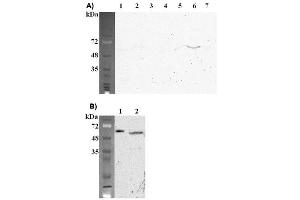 Western blot analysis using anti-FTO (mouse), mAb (FT62-6)  at 1:2'000 dilution. (FTO antibody)