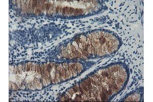 Image no. 3 for anti-F-Box Protein 42 (FBXO42) (AA 356-717) antibody (ABIN1491450) (FBXO42 antibody  (AA 356-717))