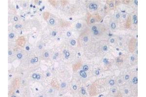DAB staining on IHC-P; Samples: Human Liver Tissue (APPL1 antibody  (AA 404-673))