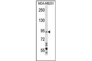 Western blot analysis of MAD1L1 Antibody (N-term) in MDA-MB231 cell line lysates (35ug/lane). (MAD1L1 antibody  (N-Term))