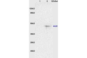 L1 rat brain lysates L2 rat heart lysates probed with Anti NK-2R/Neurokinin A Polyclonal Antibody, Unconjugated (ABIN725315) at 1:200 overnight at 4 °C. (TACR2 antibody  (AA 223-300))