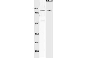 Rat brain lysates probed with Anti Synphilin-1 Polyclonal Antibody, Unconjugated (ABIN736163) at 1:200 in 4 °C. (SNCAIP antibody  (AA 51-150))