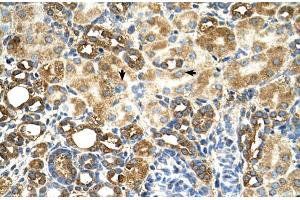 Human kidney (TAM41 antibody  (N-Term))
