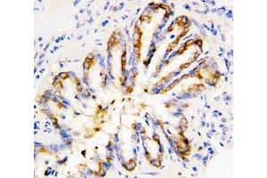 IHC-P: Calpain 1 antibody testing of rat lung tissue (CAPN1 antibody  (Middle Region))