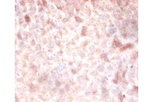Immunohistochemistry of paraffin-embedded mouse liver tissue using ABIN7150112 at dilution of 1:100 (DNMT3A antibody  (AA 680-902))