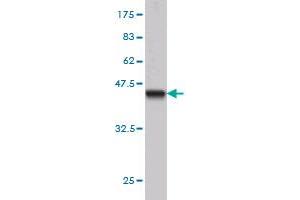 Western Blotting (WB) image for anti-B-Cell CLL/lymphoma 7B (BCL7B) (AA 124-202) antibody (ABIN564007)