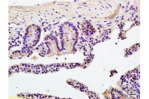 Formalin-fixed and paraffin embedded mouse colon labeled with Anti- ATP1b2/Na+K+ATPase Polyclonal Antibody, Unconjugated (ABIN738426) at 1:200 followed by conjugation to the secondary antibody and DAB staining (Atp1b2/Na+K+Atpase (AA 201-290) antibody)