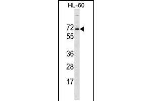 Western blot analysis in HL-60 cell line lysates (35ug/lane). (ACPL2 antibody  (AA 306-335))