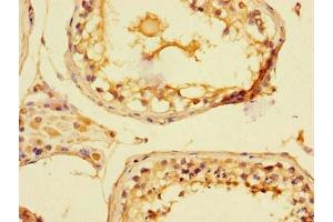 Immunohistochemistry of paraffin-embedded human testis tissue using ABIN7169145 at dilution of 1:100 (PIM2 antibody  (AA 1-210))