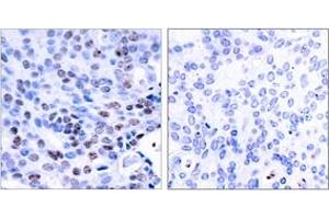 Immunohistochemistry (IHC) image for anti-Nuclear Factor of kappa Light Polypeptide Gene Enhancer in B-Cells 1 (NFKB1) (AA 304-353) antibody (ABIN2889036) (NFKB1 antibody  (AA 304-353))