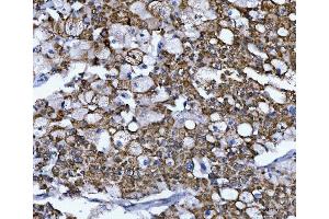 IHC analysis of NUMB using anti-NUMB antibody (ABIN3043374).