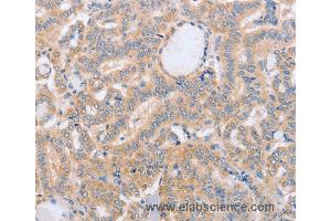 Immunohistochemistry of Human brain  using BST1 Polyclonal Antibody at dilution of 1:40