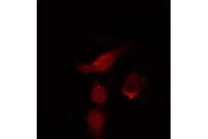 ABIN6269141 staining 293 by IF/ICC. (Src antibody  (N-Term))