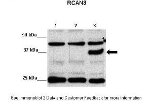 transfected HEK293 (RCAN3 antibody  (Middle Region))