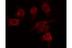 ABIN6277736 staining HepG2 by IF/ICC. (GLI1 antibody  (C-Term))
