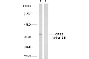 Western blot analysis of extracts from HeLa cells treated with UV, using CREB (phospho-Ser133) antibody. (CREB1 antibody  (pSer133))