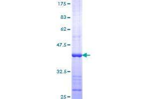 DICER1 Protein (AA 1813-1912) (GST tag)