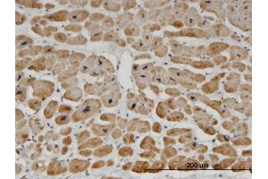 Immunoperoxidase of monoclonal antibody to ZNF239 on formalin-fixed paraffin-embedded human heart. (ZNF239 antibody  (AA 1-100))