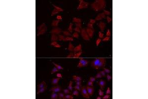 Immunofluorescence analysis of MCF7 cells using NPHP1 Polyclonal Antibody (NPHP1 antibody)