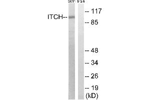 Western blot analysis of extracts from mouse brain cells, using ITCH (Ab-420) antibody. (ITCH antibody  (Tyr420))