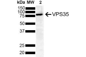 Western Blot analysis of Human SH-SY5Y showing detection of VPS35 protein using Mouse Anti-VPS35 Monoclonal Antibody, Clone 8A3 (ABIN6932977). (VPS35 antibody  (PerCP))