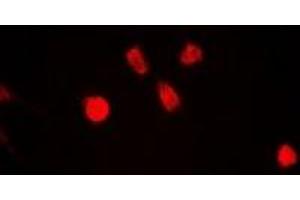 Immunofluorescent analysis of ING5 staining in A549 cells. (ING5 antibody)