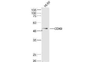 Human HL-60 lysates probed with CDK9 Polyclonal Antibody, Unconjugated  at 1:500 dilution and 4˚C overnight incubation. (CDK9 antibody  (AA 231-372))
