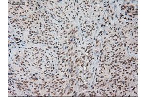 Immunohistochemistry (IHC) image for anti-Hes Family bHLH Transcription Factor 1 (HES1) (AA 1-280) antibody (ABIN2722646)