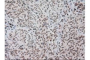 Immunohistochemical staining of paraffin-embedded kidney using anti-HES1 (ABIN2452569) mouse monoclonal antibody. (HES1 antibody  (AA 1-280))