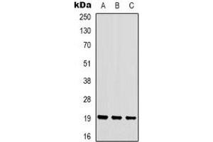 Western blot analysis of STMN1 (pS16) expression in HEK293T (A), Hela (B), Jurkat (C) whole cell lysates. (Stathmin 1 antibody  (N-Term, pSer16))