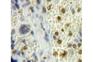 #VALUE! (Inhibitory Subunit of NF-KappaB zeta (AA 414-654) antibody)
