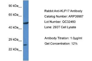 WB Suggested Anti-KLF17 Antibody Titration:  0.