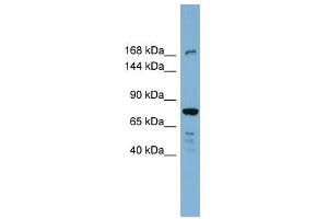 DAPK1 antibody used at 1 ug/ml to detect target protein.