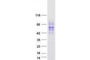 Western Blotting (WB) image for Single Immunoglobulin and Toll-Interleukin 1 Receptor (TIR) Domain (SIGIRR) (Transcript Variant 2) protein (Myc-DYKDDDDK Tag) (ABIN2732047)