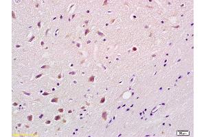 Formalin-fixed and paraffin embedded rat brain labeled with Rabbit Anti phospho-Bim(Ser87) Polyclonal Antibody, Unconjugated (ABIN682873) at 1:200 followed by conjugation to the secondary antibody and DAB staining